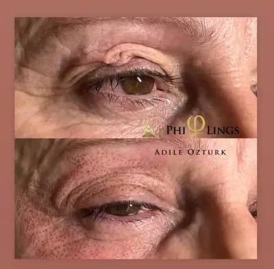 Микроблейдинг PhiBrows-Миглопластика Phi-Ion Plasma