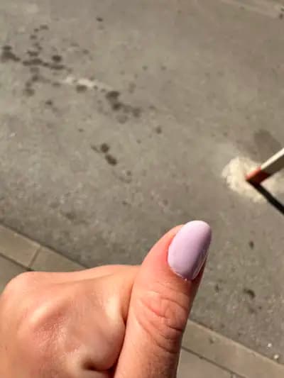 Център за лазерна епилация и естетична красота IraDerm - Пловдив