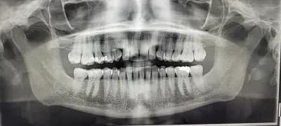 White Dent Dr. Sergeeva