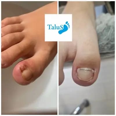 Медицински педикюр-подолог Варна "Talus"