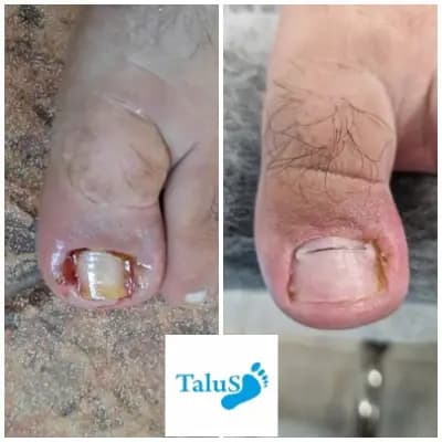Медицински педикюр-подолог Варна "Talus"