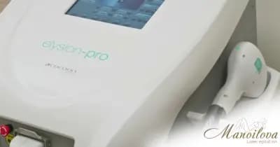 Manoilova лазерна епилация