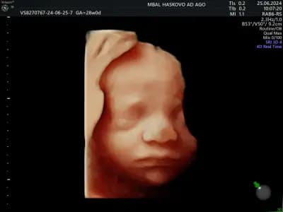 Д-р Теодор Филипов, Акушер-гинеколог