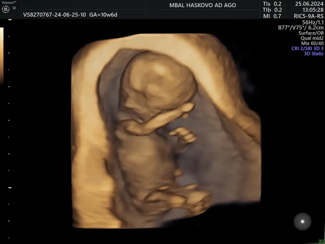 Д-р Теодор Филипов, Акушер-гинеколог