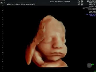 Д-р Теодор Филипов, Акушер-гинеколог