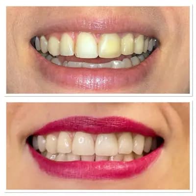 Smile Care