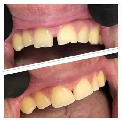 Smile Care