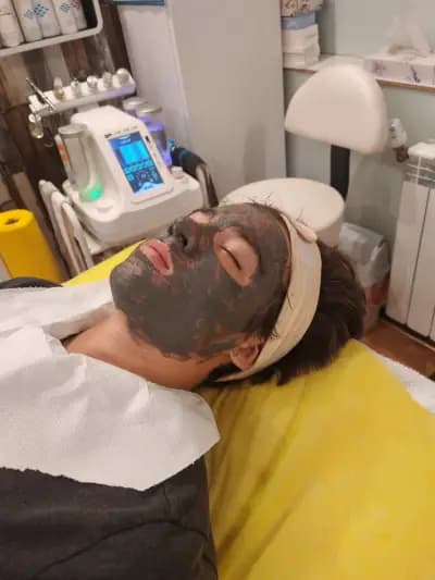 Астини 88 І Салон за красота Люлин І Терапии за лице І Химичен пилинг І Мезотерапия І Лифтинг І Микронидлинг І Кола