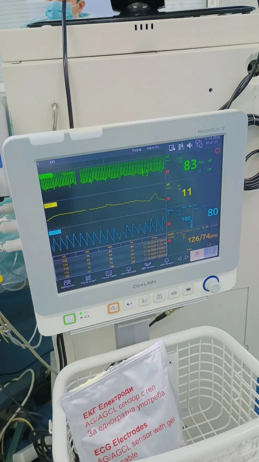 Отделение по Спешна Сърдечна Педиатрия Ет 1-ви