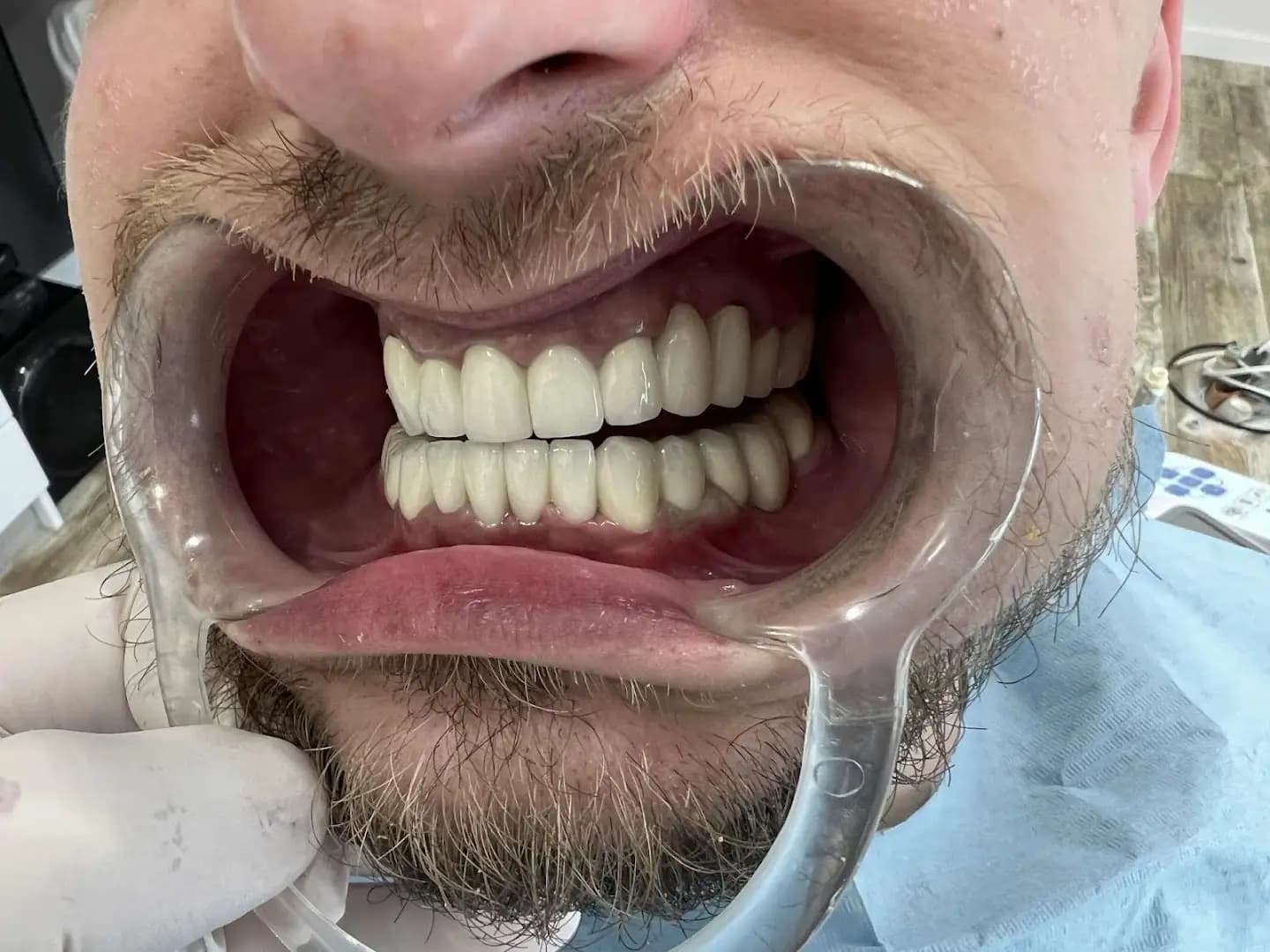 SUNSMILE | Panchevi Dental Clinic