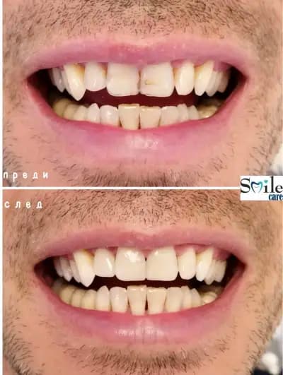 Smile Care Dr. Natalia Chervenkova