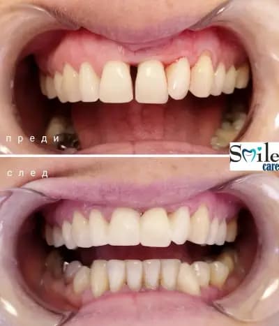 Smile Care Dr. Natalia Chervenkova