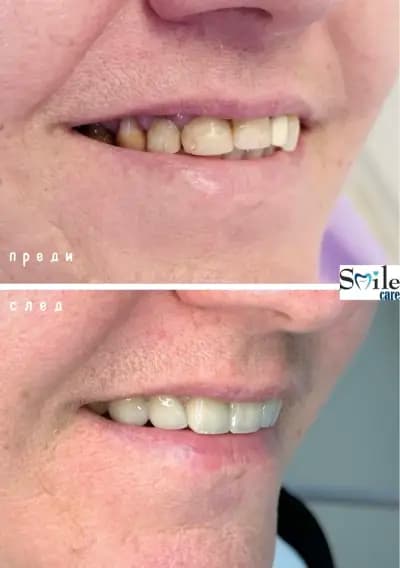 Smile Care Dr. Natalia Chervenkova