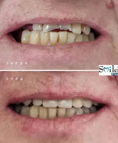 Smile Care Dr. Natalia Chervenkova