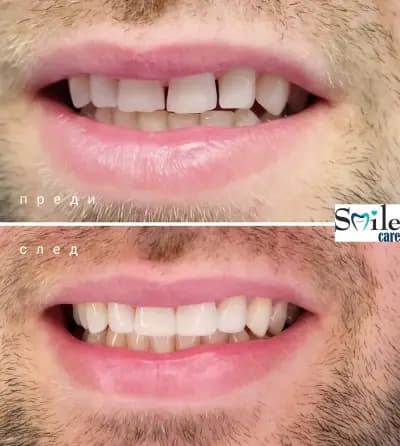 Smile Care Dr. Natalia Chervenkova