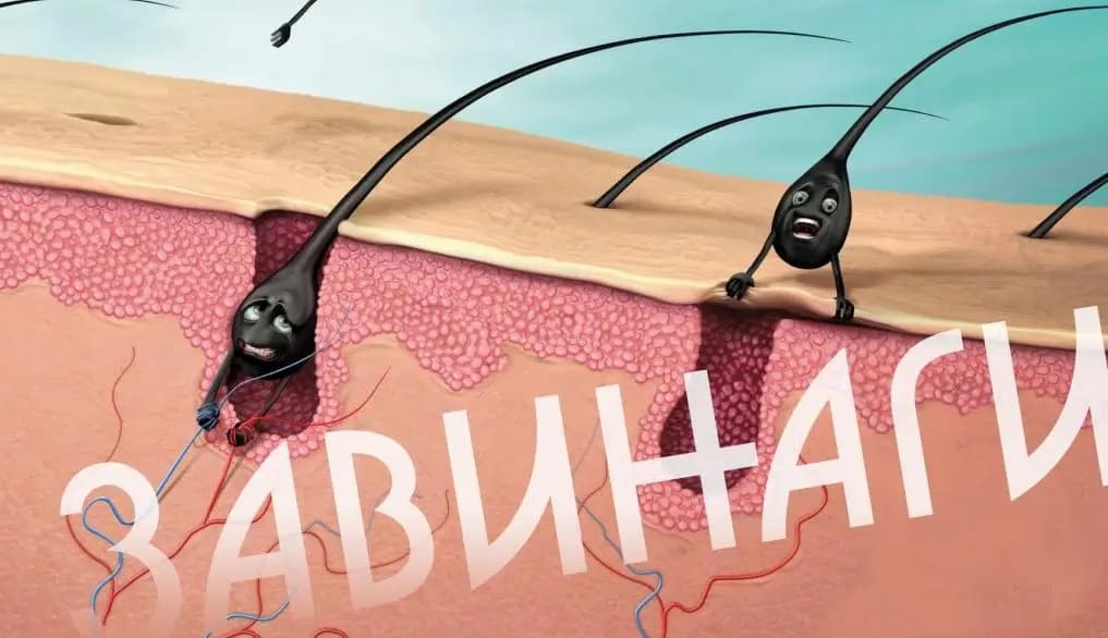 Д-р Анелия Якимова / Дерматолог, Естетични процедури, Филъри, Ботокс