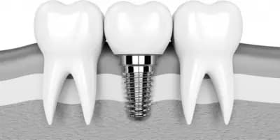 Дентална практика д-р Прокопиев, Prokopiev Dental Care