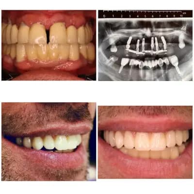 Дентална имплантология "Д-р Георги Караангов"/ Dental Implantology 'Dr Georgi Karaangov'