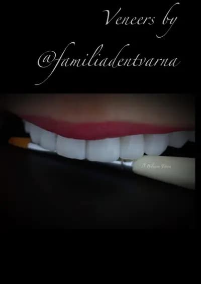 FAMILIA DENT VARNA Esthetics and Dental Tourism
