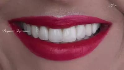 Дентална Клиника Вирту (Virtue Dental Center)