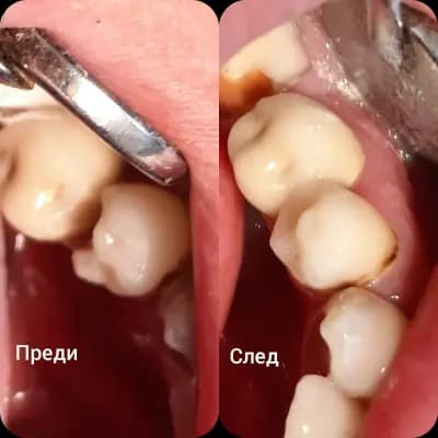Д-р Йордан Ангелов - Дентален лекар/D-r Jordan Angelov - Dentist