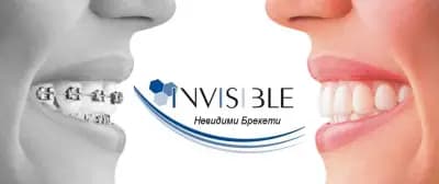 Невидими Брекети - Invisible Braces