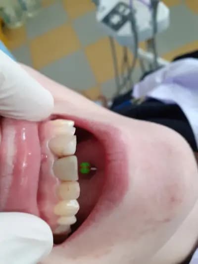 Smile in dental