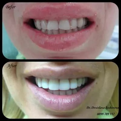 Смайл Център "SHU Smile Center "