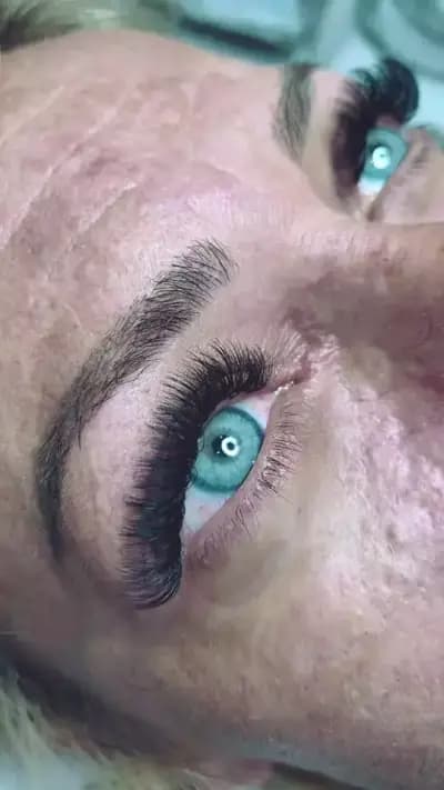 Scandall Beauty Studio І Ботокс І Подчертаване на скули І Запълване на бръчки І Корекция на носа