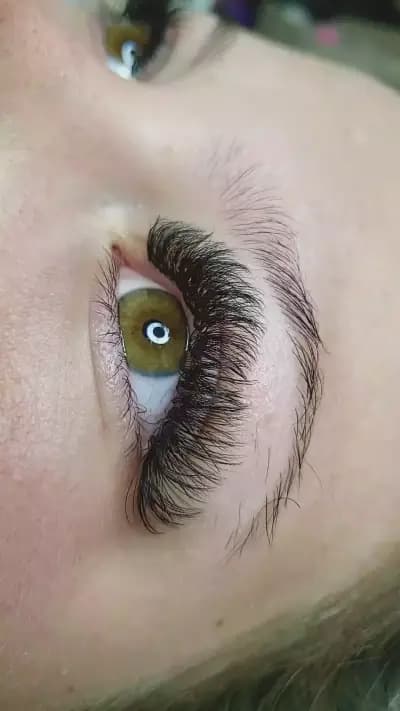 Scandall Beauty Studio І Ботокс І Подчертаване на скули І Запълване на бръчки І Корекция на носа