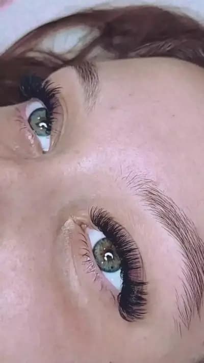 Scandall Beauty Studio І Ботокс І Подчертаване на скули І Запълване на бръчки І Корекция на носа
