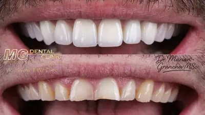 MG Dental Clinic
