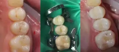 Дентално студио Golden Ratio - Стоматолог