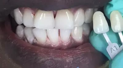 Dental Tourism in Bulgaria