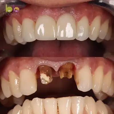 BB DENTAL CLINIC - Зъболекар в София