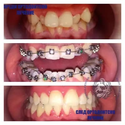 Dental Center “Saint Apollonia” Plovdiv