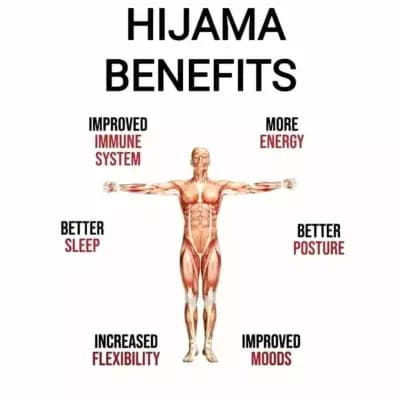 AY STAR Hijama