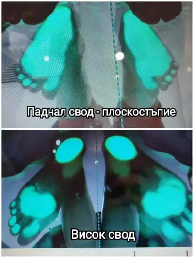 Foot Lab - Ортопедични стелки