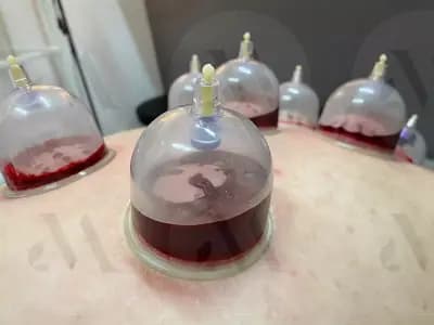 TOPAL by Mass Massage (Мануална Терапия, Физиотерапия, Лазерна Епилация и Антицелулитни Терапии)