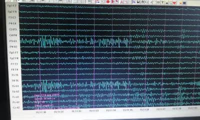 Д-р Кастрева - невролог/Dr Kastreva - neurologist