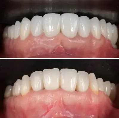 Д-р Ваня Липчева - Пародонтология | Имплантология | Естетика | Dr. Vanya Lipcheva - Periodontology | Implantology |