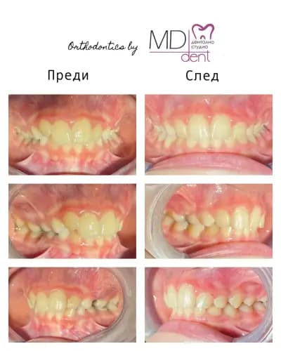 Dental Studio MD Dent Ltd Dupnitsa / Дентално студио МД Дент ООД гр. Дупница