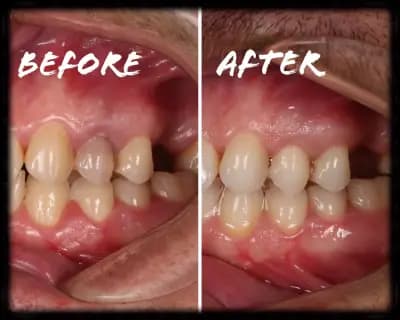 Д-р Светлин Караджов – зъболекар в Бургас, специализиран в ендодонтия под дентален микроскоп