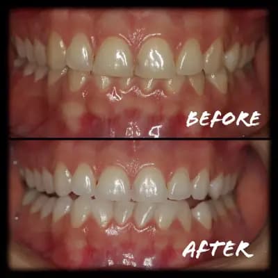 Д-р Светлин Караджов – зъболекар в Бургас, специализиран в ендодонтия под дентален микроскоп