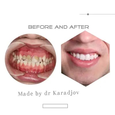 Д-р Светлин Караджов – зъболекар в Бургас, специализиран в ендодонтия под дентален микроскоп