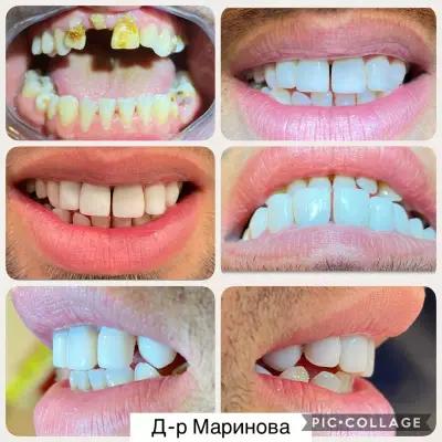 Дентално Студио "Д-р Мери Маринова"