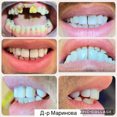 Дентална Клиника "Д-р Мери Маринова"