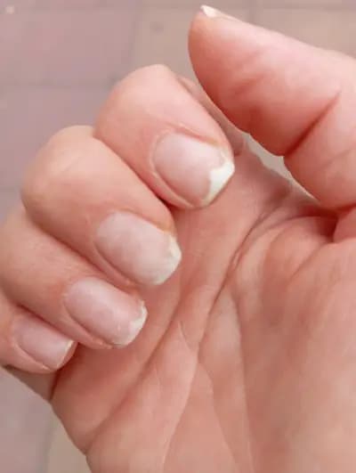 NAIL GRIMERKA