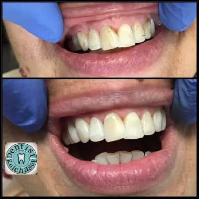 Зъболекар Колчагов Dentist Kolchagov