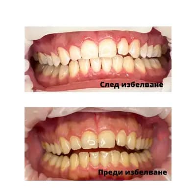 Ортодонт зъболекар София център | Twin dent